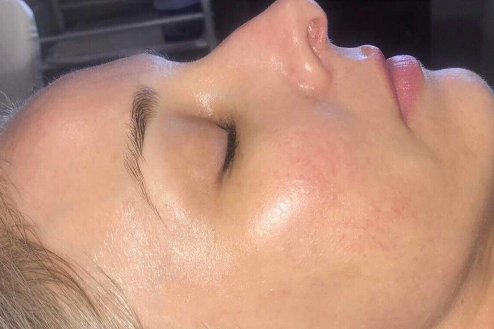 Aqua3 Facial