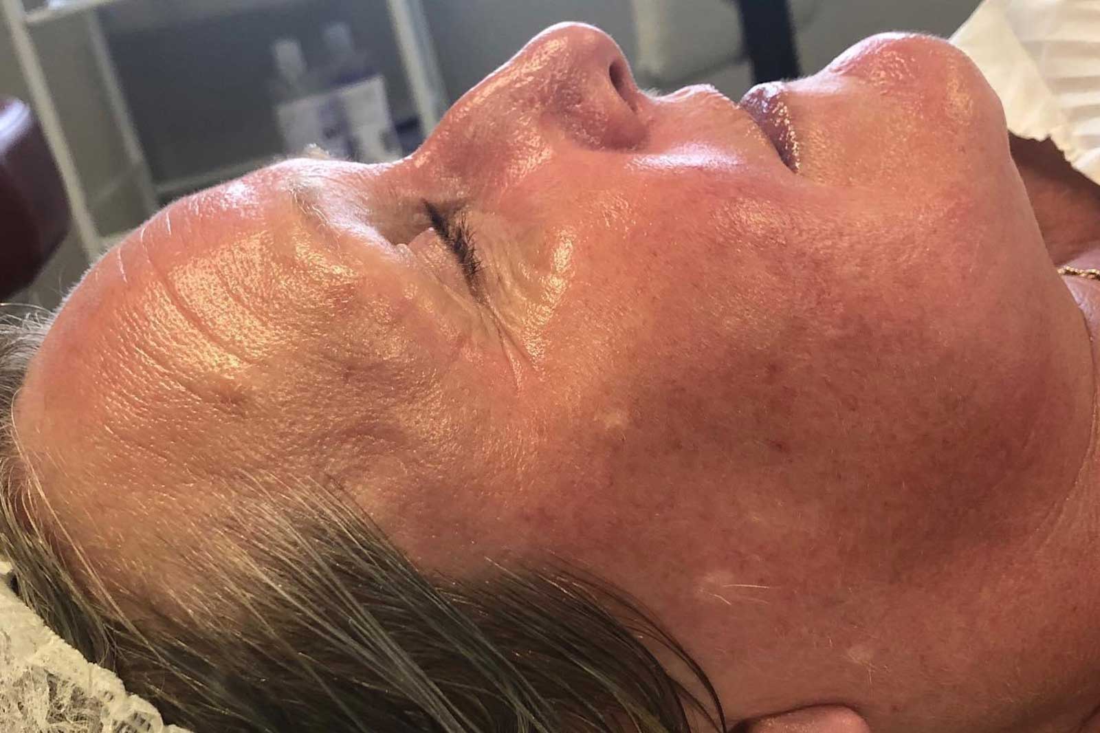 Aqua3 Facial